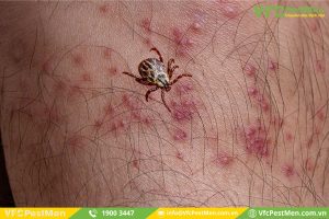 Dấu hiệu để nhận biết bị bọ ve đốt