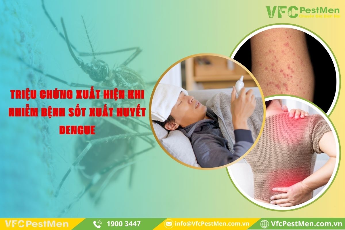 Triệu chứng khi nhiễm bệnh sốt xuất huyết Dengue